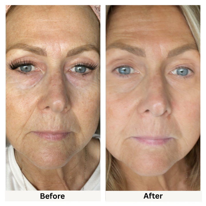 Anti-Aging Skincare Set