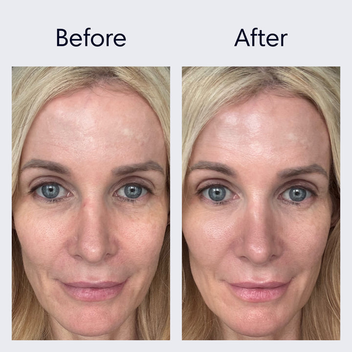Anti-Aging Skincare Set