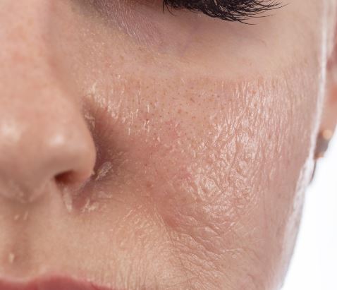 Potent Anti-Aging Skincare for Sensitive Skin